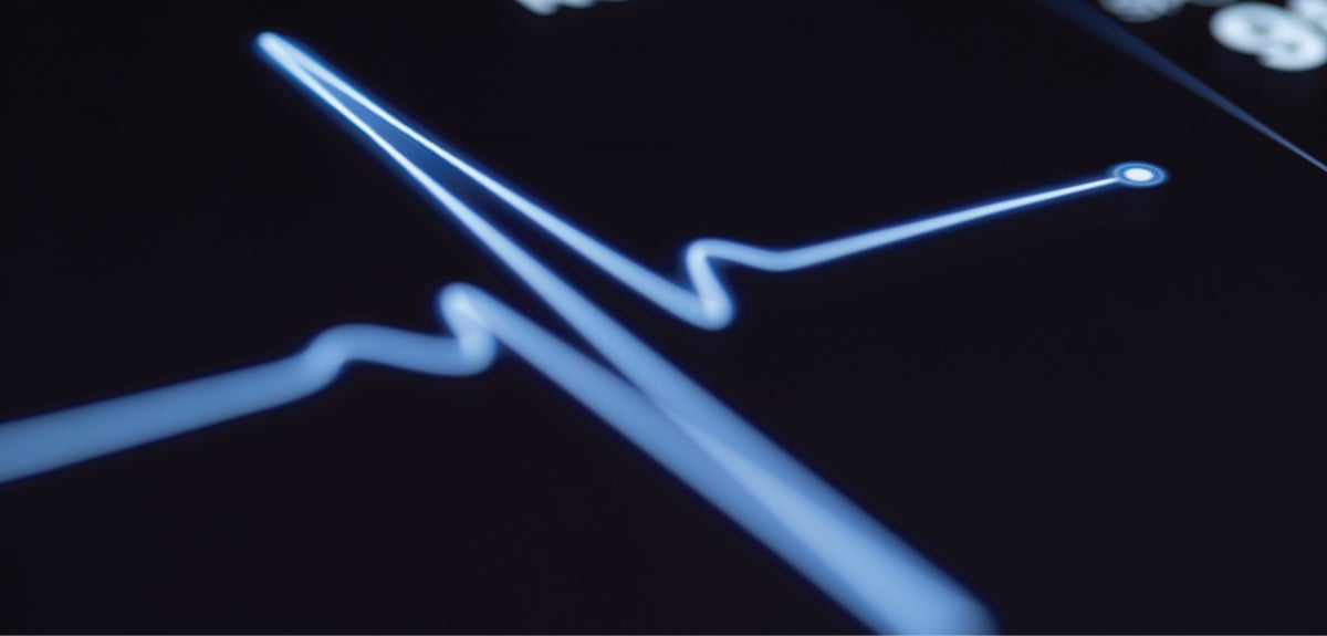 Cardiac rhythm